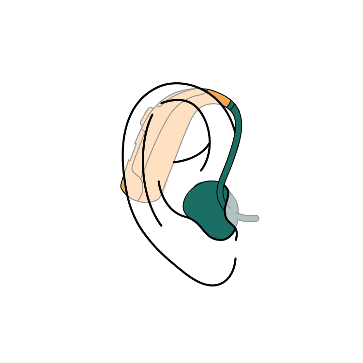 Behind-the-Ear hearing aid illustration