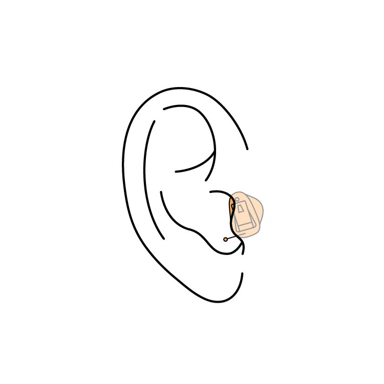 Completely-in-Canal hearing aid illustration